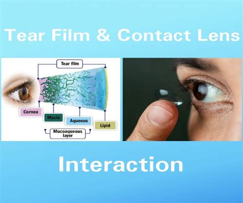 FITTING PROCEDURE FOR RIGID CONTACT LENS - Optography