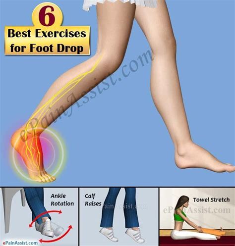 6 Best Exercises for Foot Drop | Foot drop exercises, Multiple sclerosis exercise, Foot exercises
