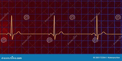 Electrocardiogram ECG Displaying Sinus Bradycardia, 3D Illustration Stock Illustration ...