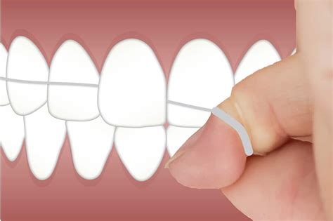 Best Tool for Flossing | Regency Dental | Best Dentist in Omaha NE