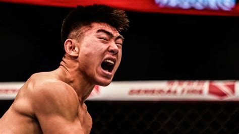 "I was seeing triple" - Song Yadong posts X-Ray of BRUTAL injury at UFC Vegas 60 – FirstSportz