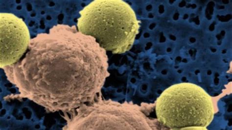 New Gene Therapy 'Precisely' Targets Cancer