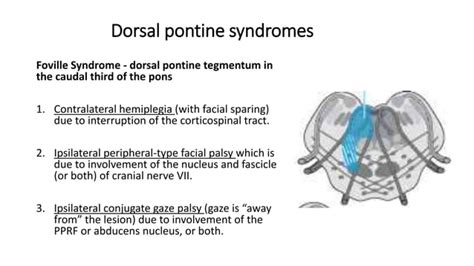 Anatomy of Pons | PPT