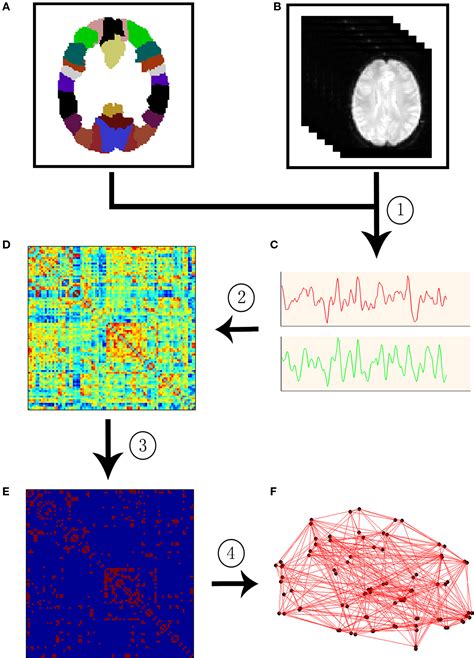 Frontiers | Graph-based network analysis of resting-state functional MRI | Frontiers in Systems ...