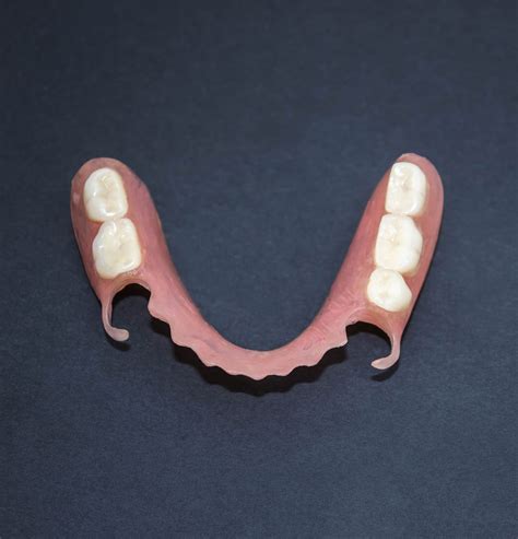 Partial Dentures | 1# Best Tooth Replacement | Dentist CO