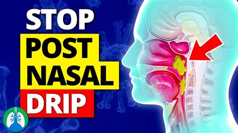 Top 10 Ways to Stop a Cough from Postnasal Drip - YouTube