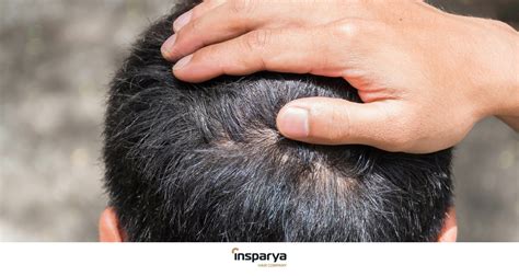 Itchy and painful irritated scalp - Solutions | Insparya Hair Clinic