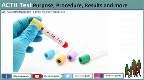 ACTH Test Purpose, Procedure, Results and more | Lab Tests Guide