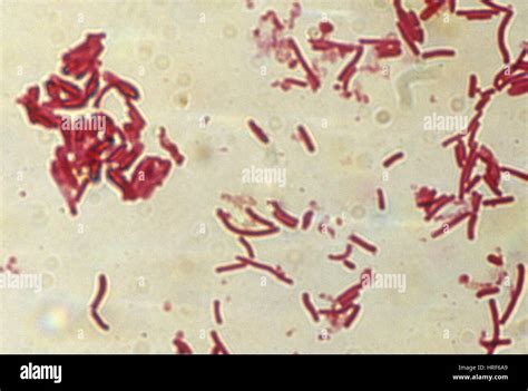 Clostridium Perfringens Gram Stain