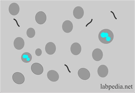 Urine Analysis – part 6 – Urine Analysis, Microscopic Findings and Interpretations – Labpedia.net