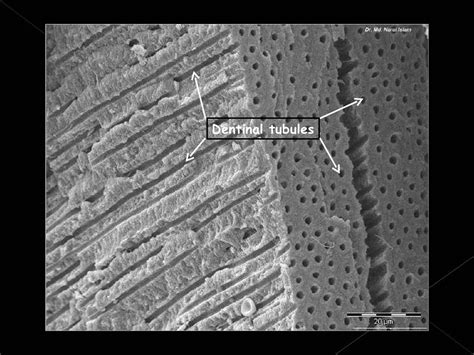 Histology of dentin