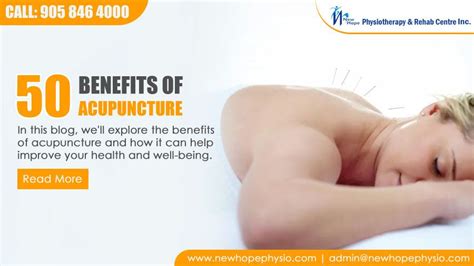 50 Benefits of Acupuncture | New Hope Physiotherapy