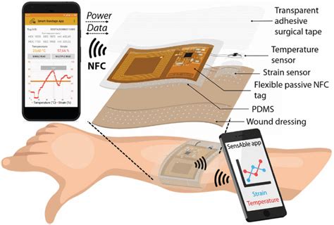 ⛑ Smart bandages can detect covid