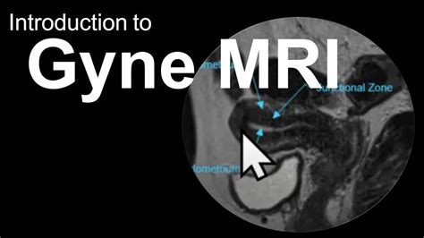 Normal Female Pelvic Mri