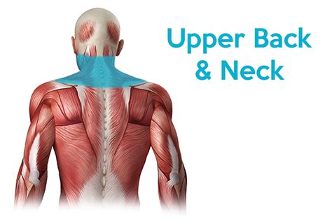 Upper Back Pain | What's Causing the Top of my Spine to Hurt?