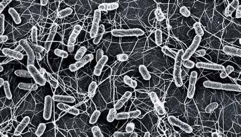 Salmonella-bacteria-electron-microscope_1600 - Futurity