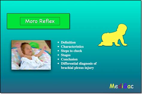 How to check Moro Reflex in Newborn babies – MediGac