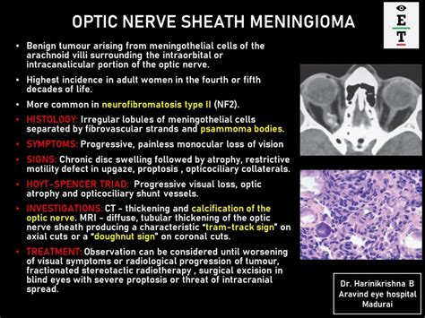 Optic Nerve Sheath Meningioma - EyeToday