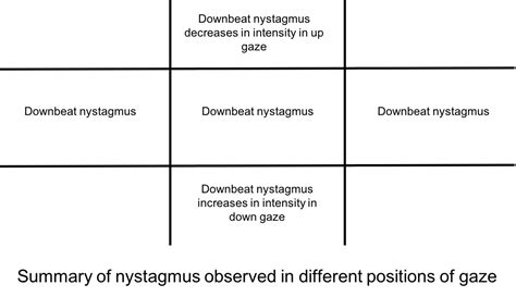 Chiari I malformation and downbeat nystagmus – Case-Based Neuro ...