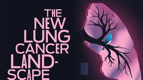 The New Lung Cancer Landscape - Cedars-Sinai Pulse