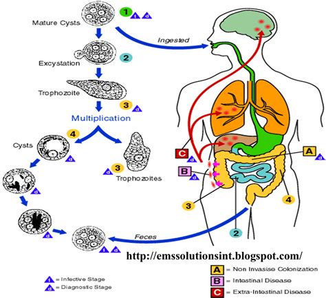 EMS SOLUTIONS INTERNATIONAL by @DrRamonReyesMD marca registrada: AMEBIASIS INTESTINAL Entamoeba ...