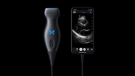 Butterfly rescinds features from handheld ultrasound device, working with FDA to re-enable ...