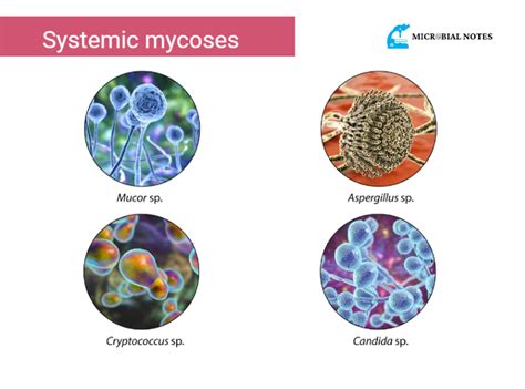 Systemic mycoses - Its Definition, Types, and Treatment - Microbial notes