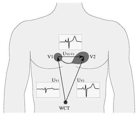 entrada Hamburguesa Cap sensor ecg Matemático Agradecido cápsula