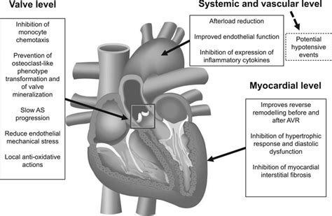 Medical Treatment of Aortic Stenosis | Circulation