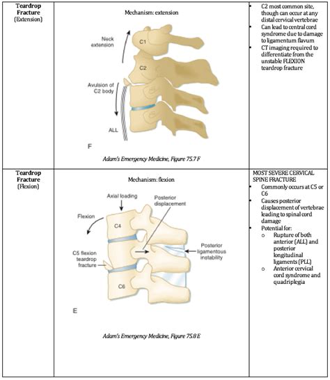 Unstable Cervical Spine Fractures — NUEM Blog