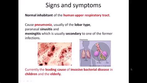 Streptococcus pneumoniae infection and disease - YouTube