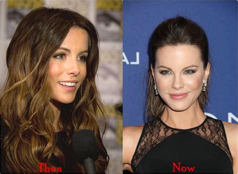 Kate Beckinsale Nose Job Plastic Surgery Before And After Photos | 2018 ...