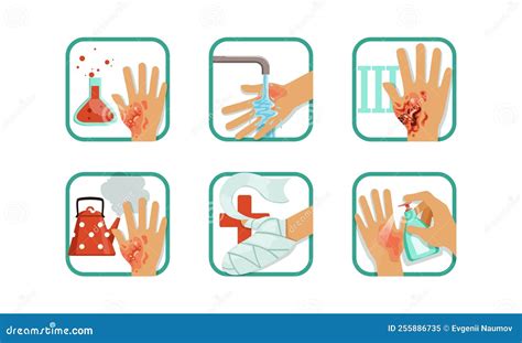 Burns Degree and First Aid or Treatment with Wounded Hand Vector Set ...