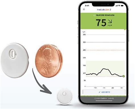 FDA clears Abbott’s FreeStyle Libre 2, 3 sensors with automated insulin ...