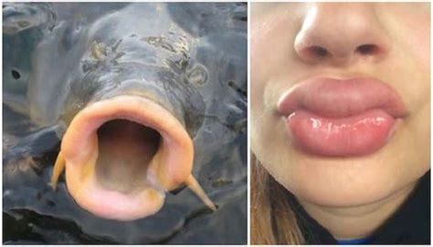 The Kylie Jenner Lip Challenge Continues To Give Girls Fish Lips (14 pics)