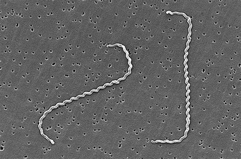 Leptospira (bactéria) – Wikipédia, a enciclopédia livre