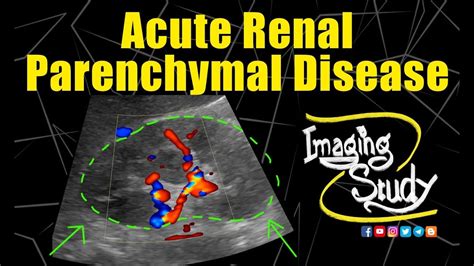 Acute Renal Parenchymal Disease || Ultrasound || Case 181 - YouTube