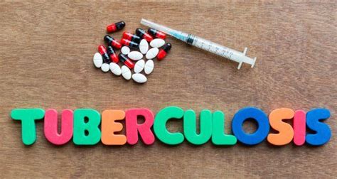 Treating TB with antibiotics might worsen the condition - Read Health ...