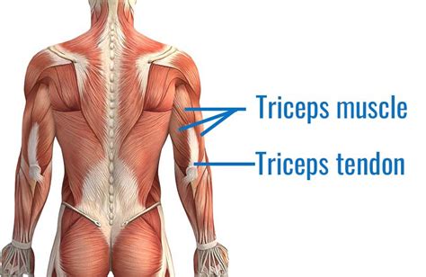 Triceps tendonitis causes and treatment