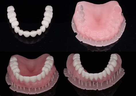 Print a Pair: 3D Printed Dentures with Moonray - Digital Enamel