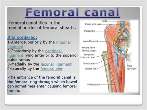 Femoral Ring Boundaries