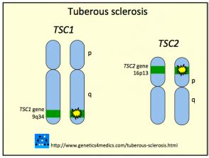 Esclerosis tuberosa - Hoogstra - Centros Medicos