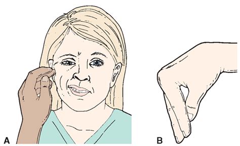 Chvostek's and Trousseau's signs - hypocalcemia | Nursing school ...