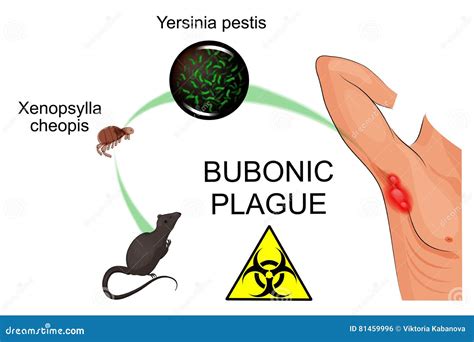 Bubonic Plague Symptoms Clipart