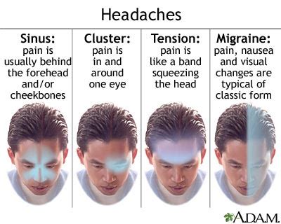 Medical and Health Information: Sinus Headache (cont.)