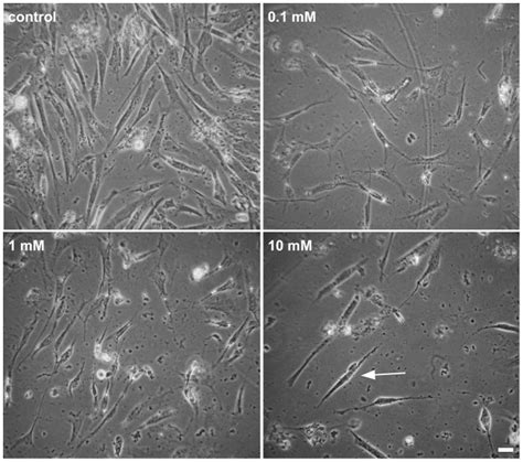 Phase contrast microscopy shows that cells treated with 1 or 10 mM of ...