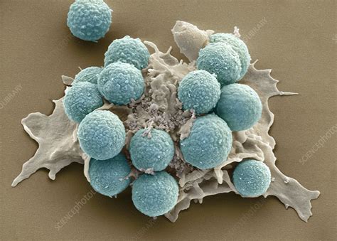 Phagocytosis of fungus spores, SEM - Stock Image - P266/0145 - Science Photo Library