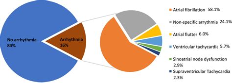 The most frequent arrhythmia in asthma hospitalization | Download ...