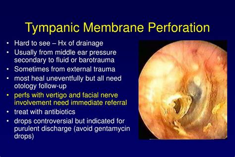 Perforated Tympanic Membrane Treatment