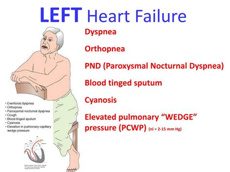 PPT - THE HEART PowerPoint Presentation, free download - ID:2264653